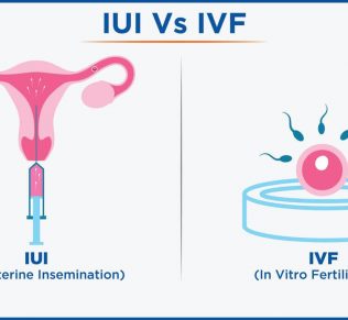 IVF clinic in Bangalore