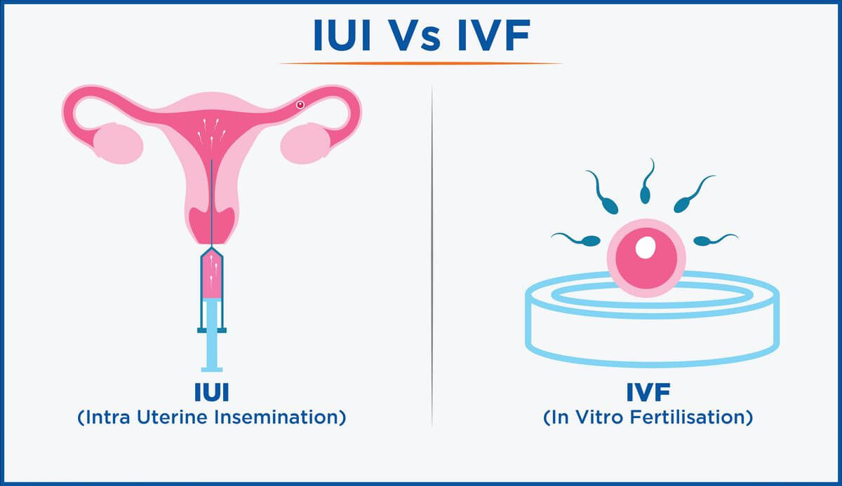 IVF clinic in Bangalore