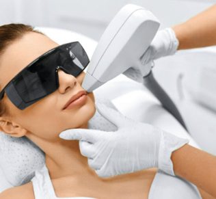 laser hair removal